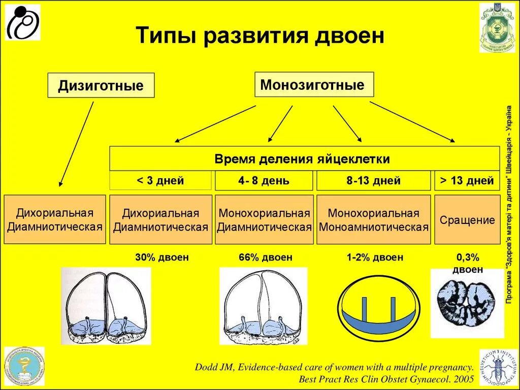 Виды двойни. Монохориальная моноамниотическая многоплодная беременность. Разновидности двойни. Зигота близнецов это. Виды двойни.