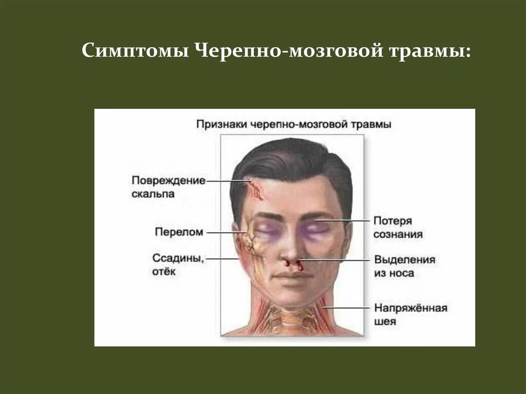 Черепно мозговая трамв. Симптомы при черепно мозговой травме. Черпная Мозгово травма. Внешние проявления черепно мозговой травмы. Больной с чмт