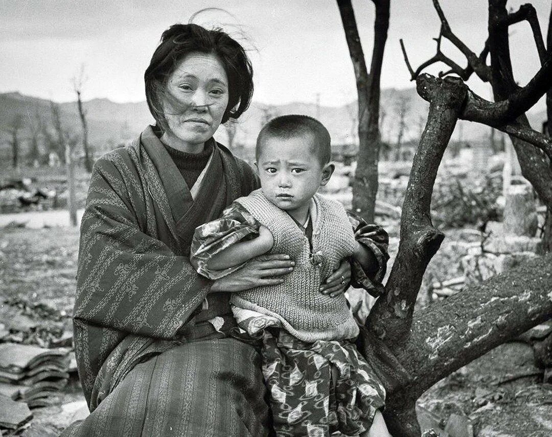 Бомбардировка хиросимы и нагасаки. Япония 1945 хиросима и нагасаки люди. Япония нагасаки 1945 мальчик. Нагасаки люди. Нагасаки люди.