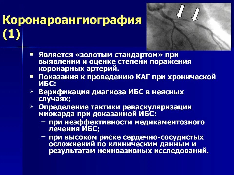 Коронарные артерии сердца на коронарографии. Метод исследование коронарография. Коронарография при инфаркте миокарда. Коронароангиография ИБС.