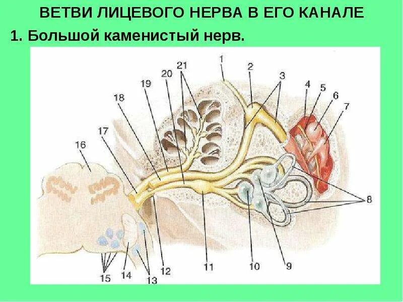 Лицевой нерв височная кость. Большой каменистый нерв. Лицевой нерв височная кость. Канал большого каменистого нерва. Коленце канала лицевого нерва.
