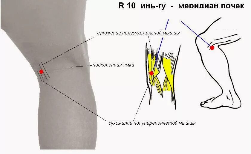 Болит под коленом что это может быть. Подколенные лимфатические узлы. Лимфоузлы подколенные болят. Подколенные лимфоузлы расположение. Лимфоузел под коленкой.