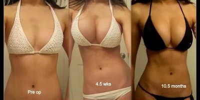 грудь 4 размера сравнение