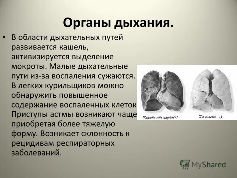 анатомо физиологические особенности при бронхиальной астме. параметры ивл. малые дыхания. строение верхних дыхательных путей человека анатомия. гиперсекреция бронхов.