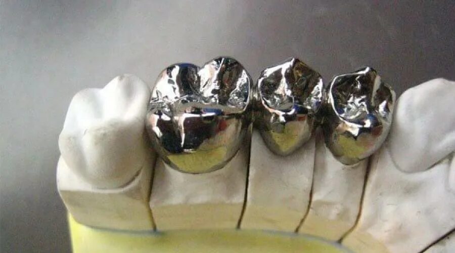 Штампованные коронки на зубы. Коронка цельнолитая (никель хром). Коронка цельнолитая (сплав remanium). Мостовидные протезы металл цельнолитые. Штампованные Серебряно-палладиевые коронки.