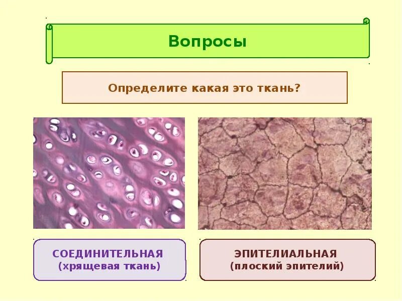 Ткань 1)  соединительная 2)  эпителиальная. Соединительная ткани хрящевая биология. Эпителиальная ткань и соединительная ткань. Ткани эпителиальная соеди. Клетки эпителиальной ткани виды