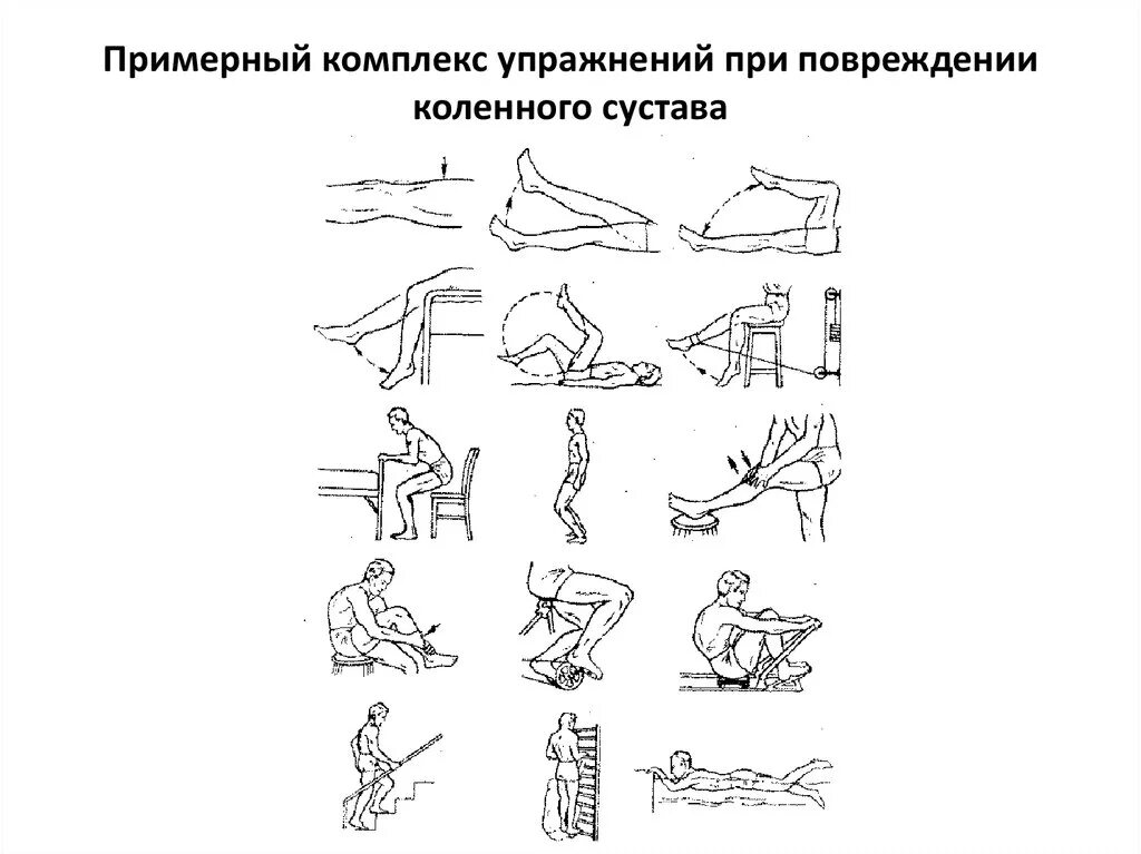 ЛФК после операции мениска коленного сустава комплекс упражнений. Упражнения для реабилитации коленного сустава после травмы. Упражнения реабилитация после перелома надколенника. Гимнастика. ЛФК после артроскопии коленного сустава. Восстановление организма после операций