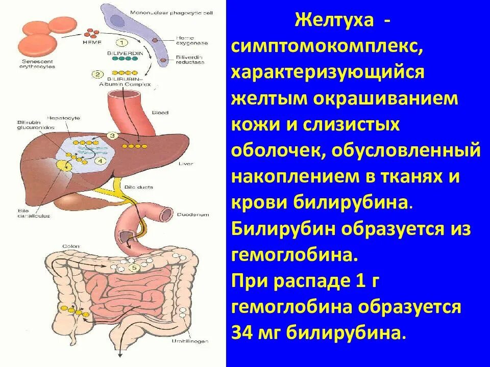 Печеночная желтуха билирубин. Паренхиматозная желтуха билирубин. паренхиматозная желтуха у новорожденных патогенез. билирубин этиология. патогенез билирубина.