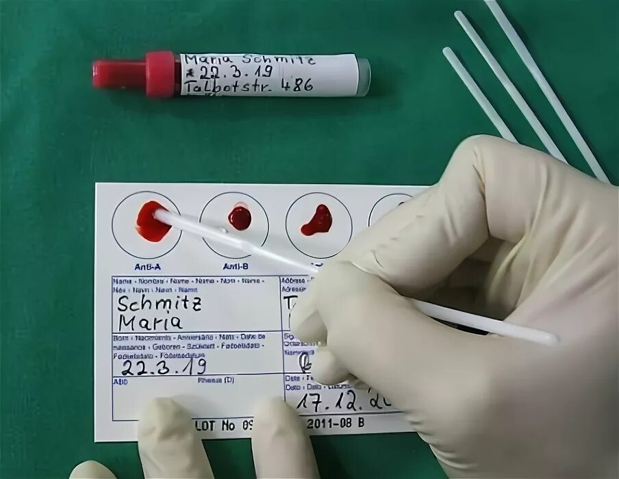 Тест на резус фактор. Анализ на группу крови. Анализ крови на группу и резус. Анализ на группу крови и резус-фактор. Тест на группу крови резус.