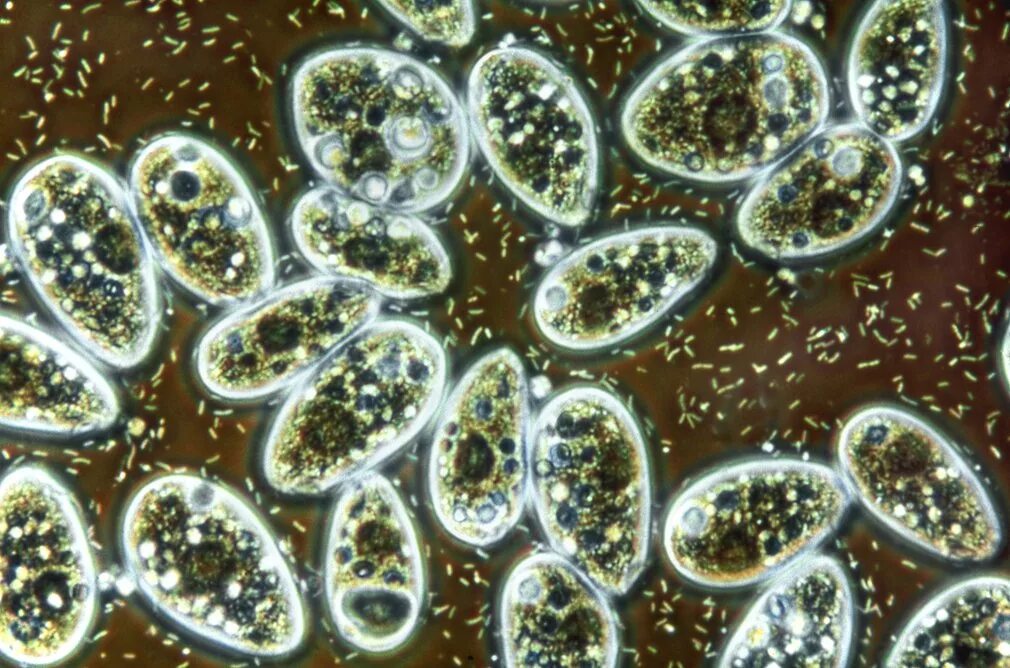 простейшие под микроскопом. инфузория-туфелька это бактерия. инфузория туфелька микрофотография. инфузория туфелька. инфузория туфелька коловратка.