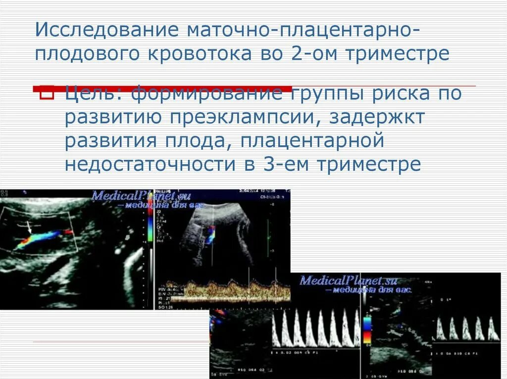 Плацентарный кровоток. Маточно плодово плацентарный кровоток. Маточное плодовый кровоток это что такое. Плацентарное кровообращение. Маточная гемодинамика