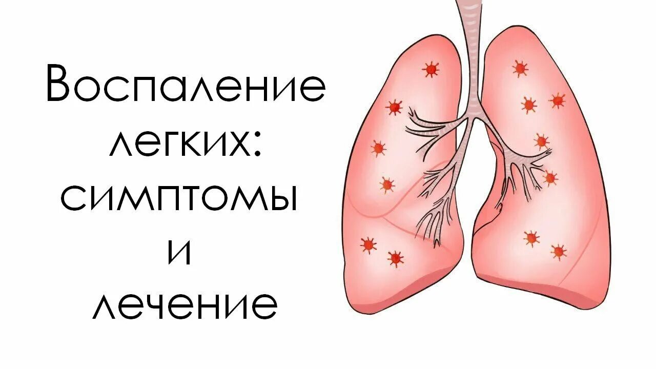 Воспаление лёгких симптомы. Симптомы воспаления легких. Боль в легком при пневмонии