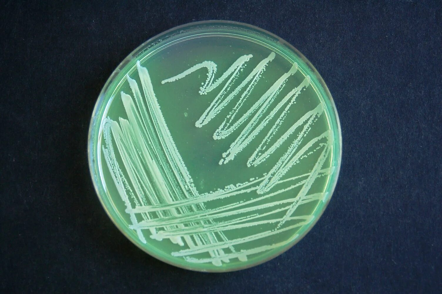 Pseudomonas aeruginosa цетримидный агар. Колония бактерий Pseudomonas Fluorescens. Pseudomonas aeruginosa колонии.