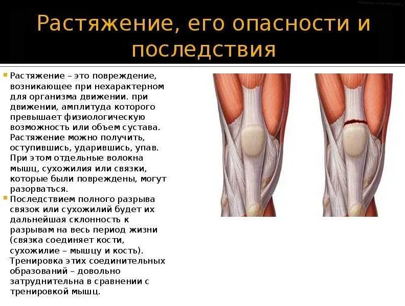 Потянул под коленом