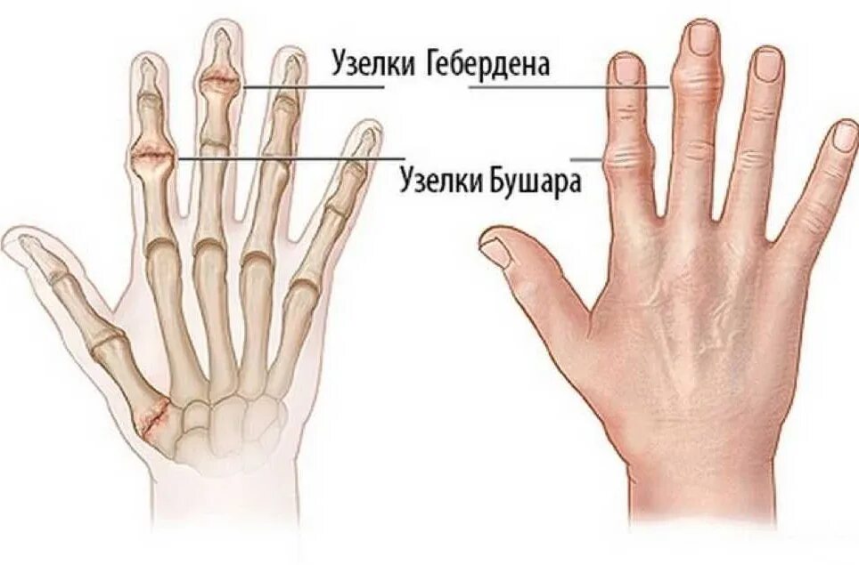 Форма указательного пальца