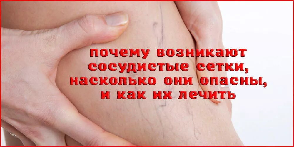 Как убрать капиллярные сетки