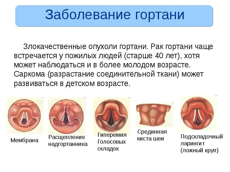 Что такое может быть на
