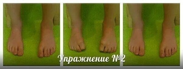 Вальгусная деформация стопы у детей упражнения. Массаж для стоп при вальгусной деформации стопы у детей. гимнастика для стоп при вальгусной деформации большого пальца. массаж при вальгусной деформации стопы у детей. упражнения при вальгусе стопы.