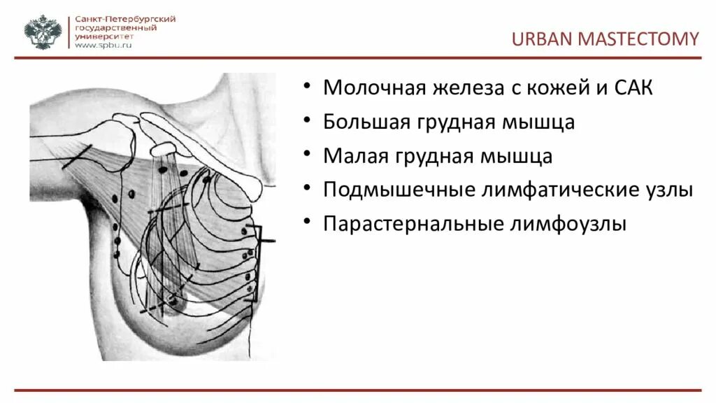 Лимфоузел зоргиуса в молочной железе расположение Парастернальные лимфатические узлы на узи при раке молочной железы фото презен