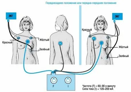 Датчики холтера схема