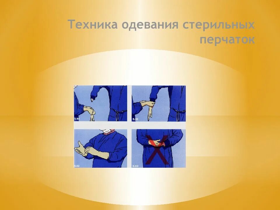 Стерильные перчатки алгоритм. Техника одевания перчаток. Технология одевания стерильных перчаток. Одевание стерильных перчаток алгоритм на себя. Техника одевания хирургических перчаток.