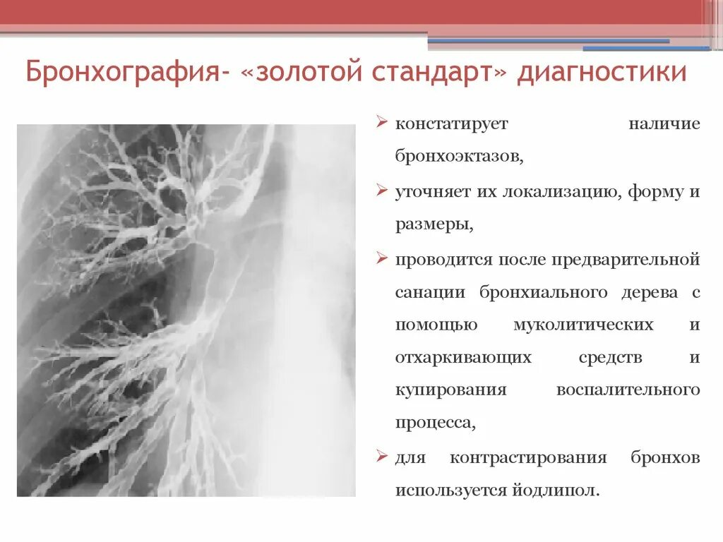 Бронхит бронхоэктатическая болезнь. Бронхоэктатическая болезнь фибробронхоскопия. Бронхоэктатическая болезнь бронхография. Бронхография описание снимка.