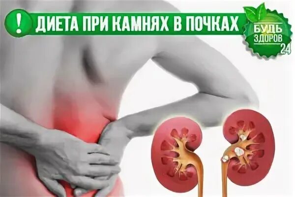Диета при камнях в почках