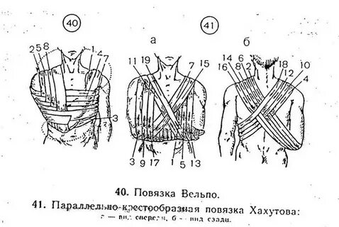 Дезо алгоритм