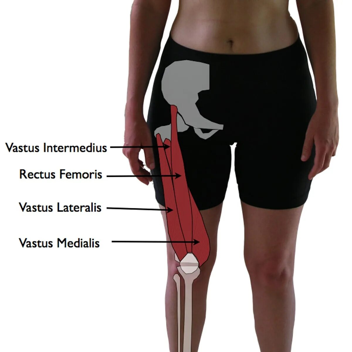 M rectus femoris.