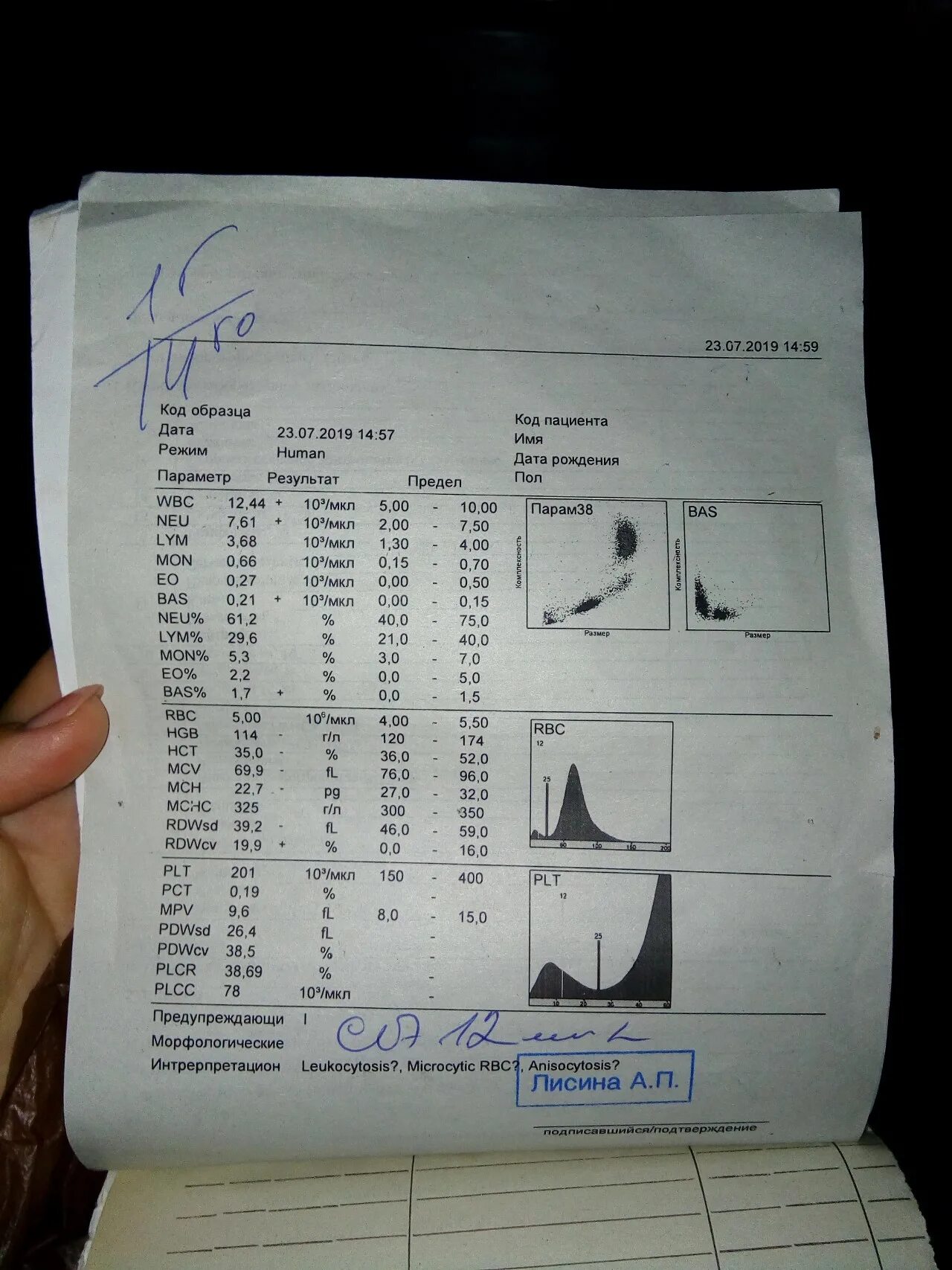 Plcr в анализе крови. PLCC В анализе крови. PLCR это что в анализе крови. Общий анализ графики. Общий анализ крови чек.