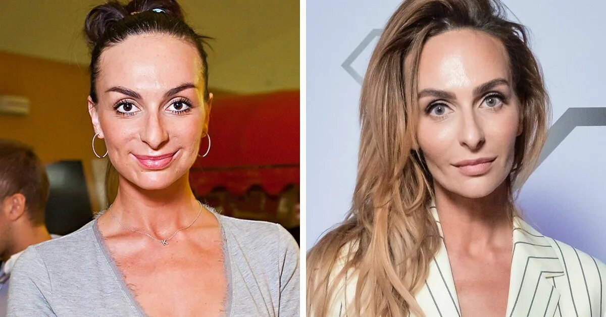 Варнава ринопластика. Как сейчас выглядит варнава. Варнава сейчас 2022. Катя варнава в молодости. Как сейчас выглядит варнава.