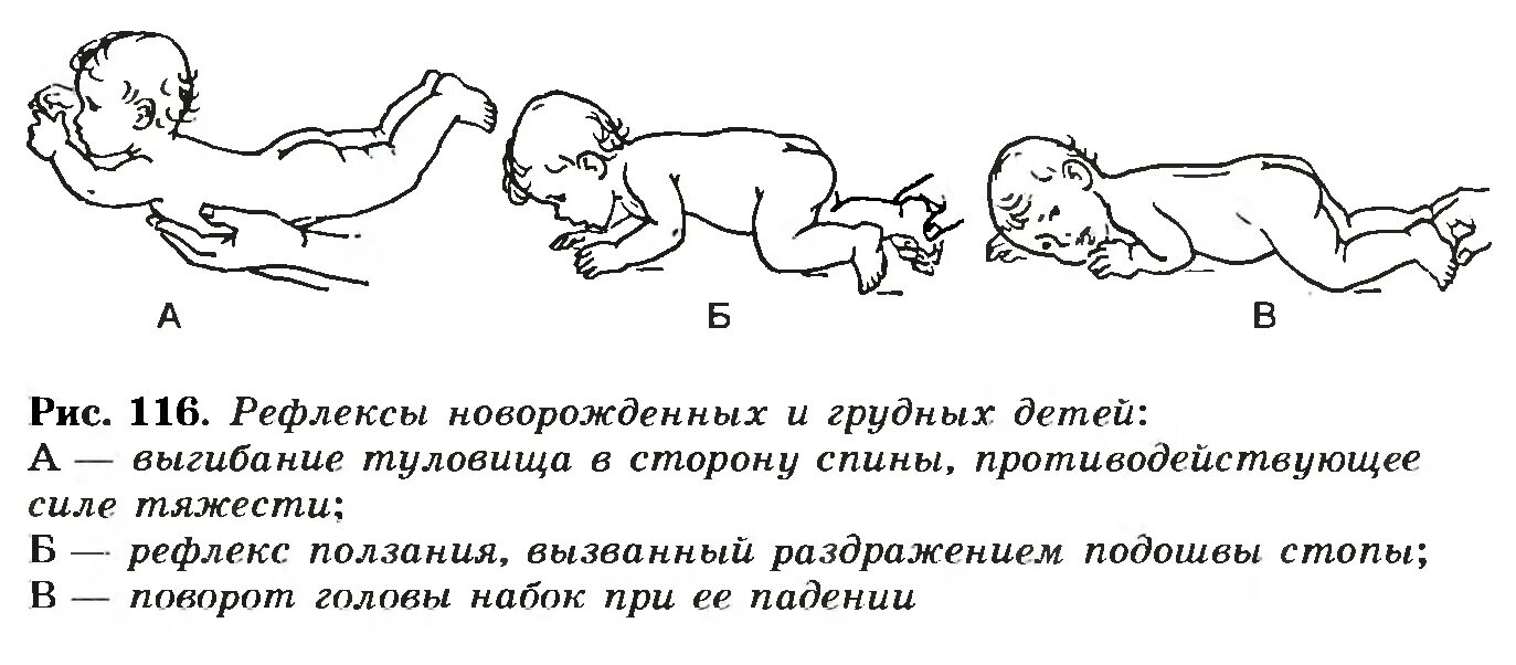 Почему пропадают рефлексы. Безусловные рефлексы у детей 1 года жизни. Рефлексы при ДЦП У детей до года. Рефлексы новорожденных с 1 месяца у новорожденных. Рефлексы новорождённых таблица безусловные.