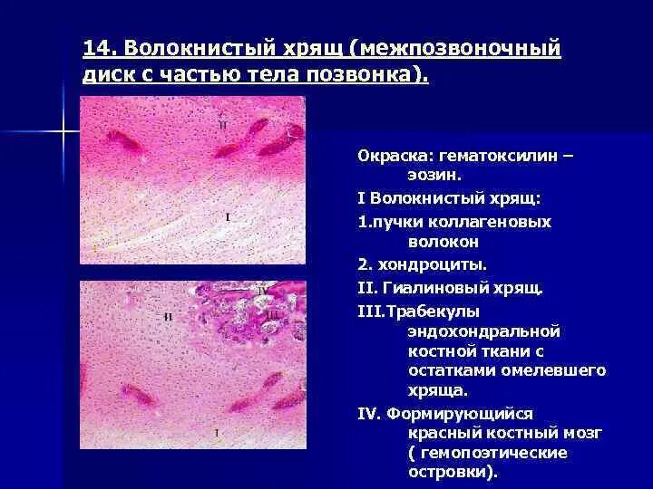 Коллагенвоволакнистый хрыщ препарат. Волокнистый хрящ микропрепарат. Хрящевая ткань волокнистый хрящ. Хрящевая ткань волокнистый хрящ. Волокнисто хрящевой.