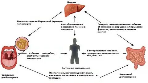 Дисбактериоз полости рта лечение