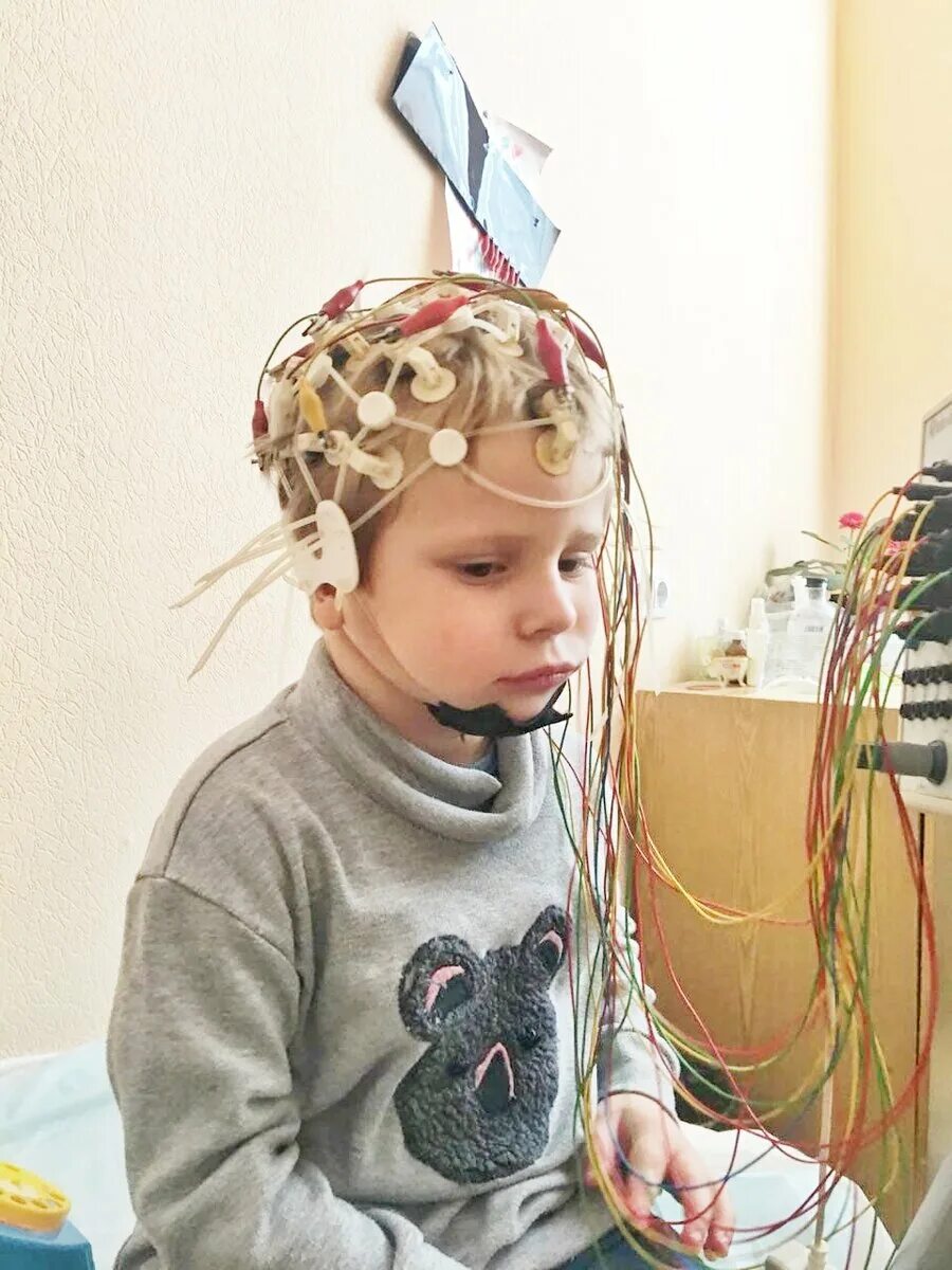 Энцефалограмма мозга ребенку