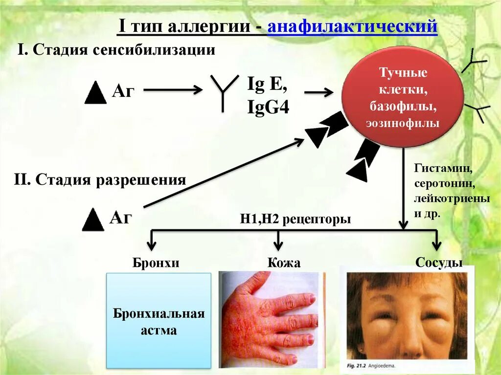 Анафилактический шок аллерген. Аллергия анафилактический ШОК. Аллергическая реакция.