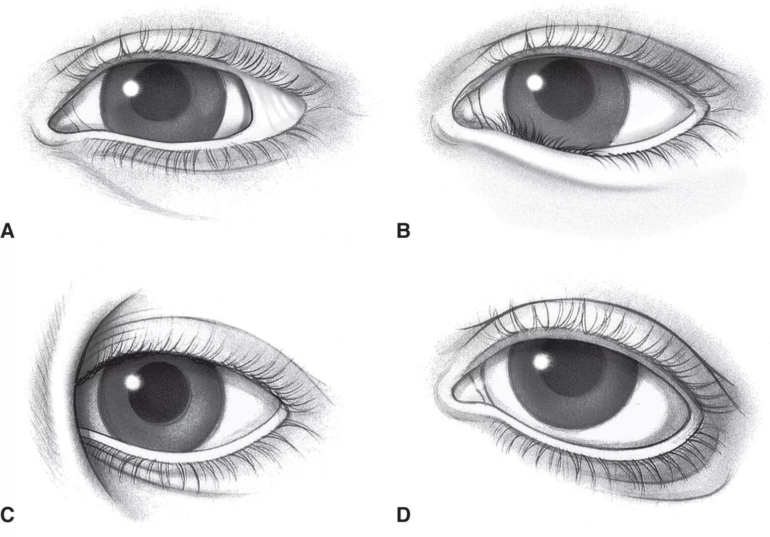 Eye corner. Эпикантус монгольская складка. Эпикант, монголоидный разрез глаз. Разрез глаз эпикантус. Монголоидный разрез глазных щелей эпикантус.