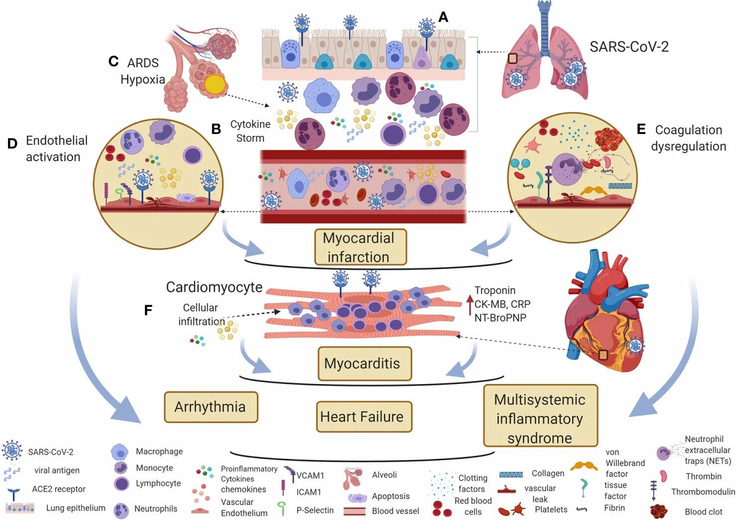 SARS-cov-2 and Thrombosis. Иммунология фон. SARS-cov-2 and epithelium. Life circle of SARS cov 2. Diseases associated