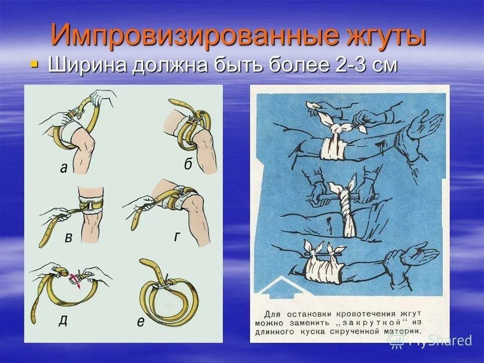 Импровизированные жгуты. Ширина жгута для остановки кровотечения. Импровизированный жгут для остановки кровотечения. Ширина импровизированную кровоостанавливающего жгута.