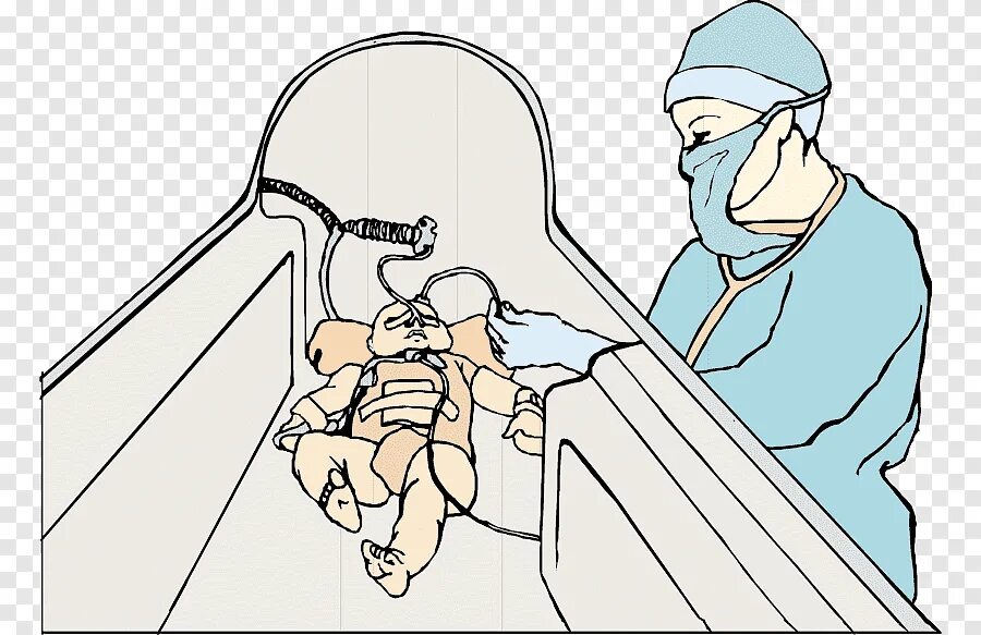 Асфиксия новорожденных сестринский. Асфиксия новорожденных сестринский уход. Асфиксия новорожденных рисунок. Реанимация новорожденных рисунок.