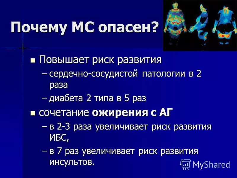 История операционной системы ms dos презентация. Распространенность метаболического синдрома в мире. Рэпер нойз мс. Правило минимизации убытков. Detroit rip rap.