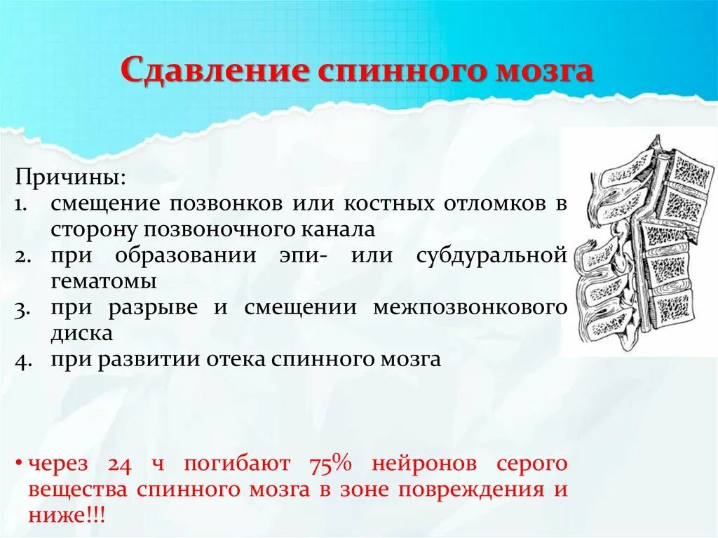 Сотрясение позвоночника. Сдавление спинного мозга. Причины сдавления спинного мозга. Компрессия спинного мозга. Сдавливание спинного мозга симптомы.