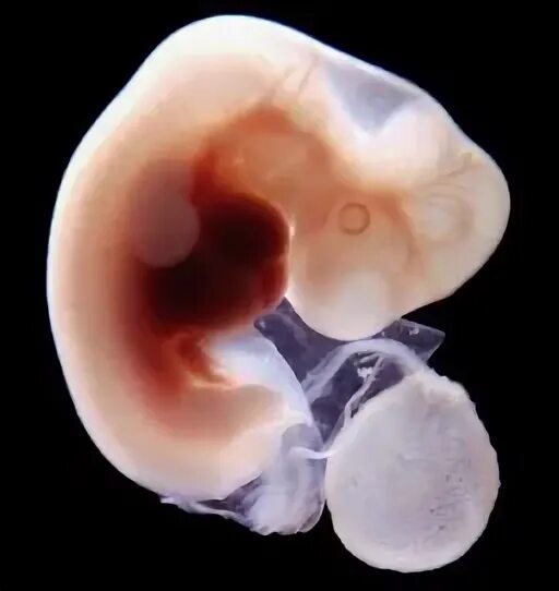 Беременна 2 месяц. Эмбрион на 2 месяце беременности. Эмбрион 2 недели беременности фото плода.