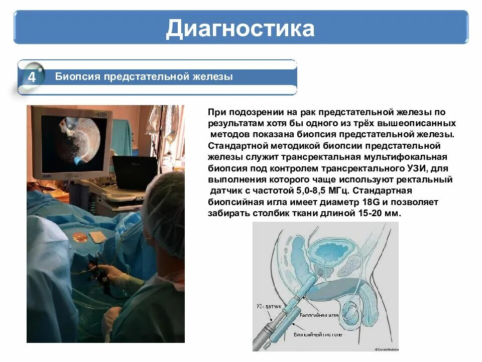 Урок простаты. Биопсия предстательной железы. Трансректальная мультифокальная биопсия предстательной железы. Методы диагностики простаты. Методы биопсии предстательной железы.