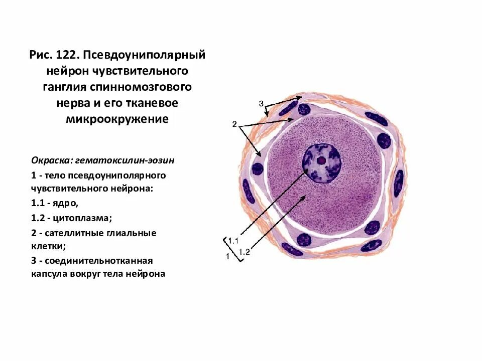 Клетки спинномозгового узла. Нервные клетки спинального ганглия гистология. Нервные клетки спинального ганглия строение. Псевдоуниполярные нервные клетки (спинномозговой узел).. Нервные клетки спинномозгового узла рисунок.