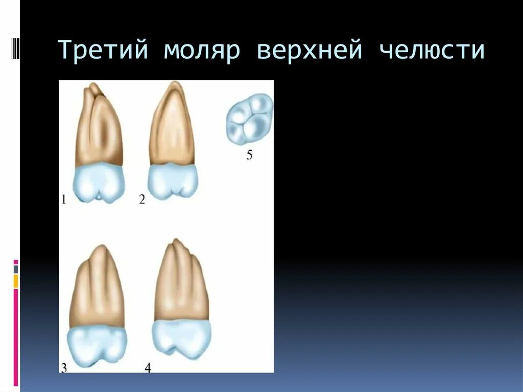 Первый моляр верхней челюсти. Третий моляр верхней челюсти моделирование. Третий верхний моляр анатомия. 3 Моляр верхней челюсти анатомия. Третий моляр верхней и нижней челюсти.