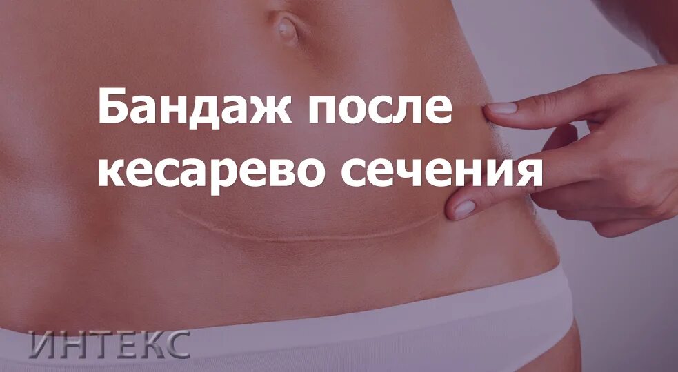 Бандаж после кесарево сечение. Бандаж послеоперационный после кесарева сечения. Бандаж после кесарева сечения после. Послеоперационный пояс после кесарева сечения.