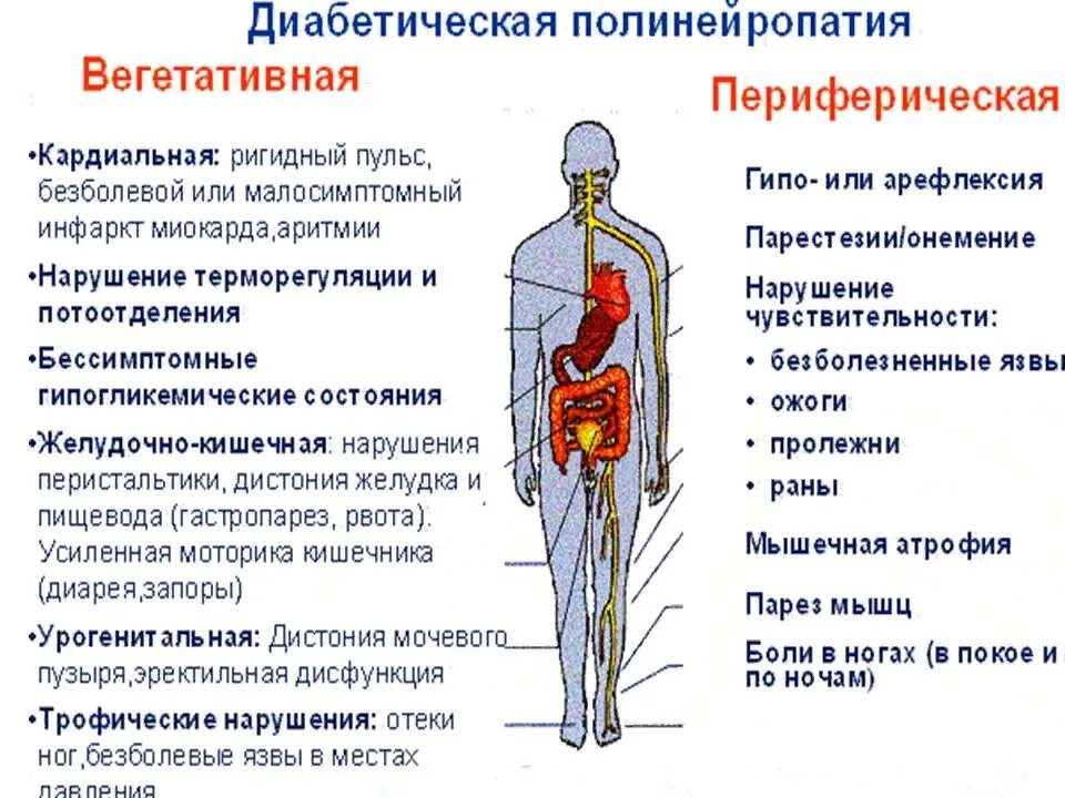 Что такое периферическая нейропатия. Терапия схема диабетическая полинейропатия. Полинейропатия осложнение сахарного диабета. Схема терапии полинейропатии диабетической. Диабетическая полинейропатия нижних конечностей синдромы.