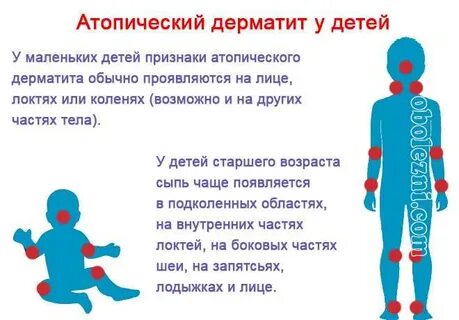 Дерматит лечение подросток