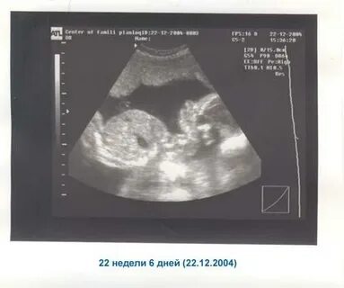 21 неделя 2014